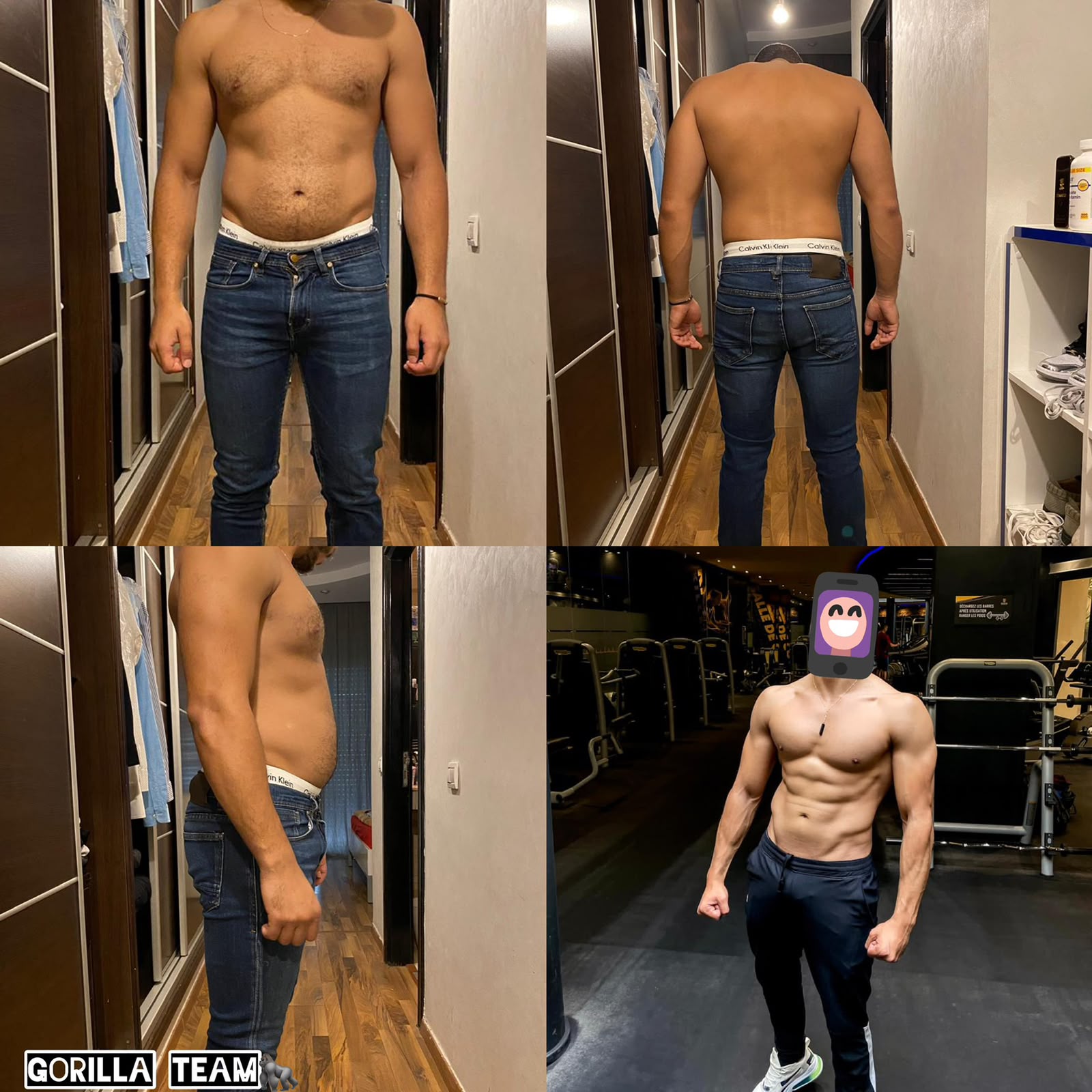Photos avant et après d’un client : vue de face, de dos et de profil, puis la forme finale
