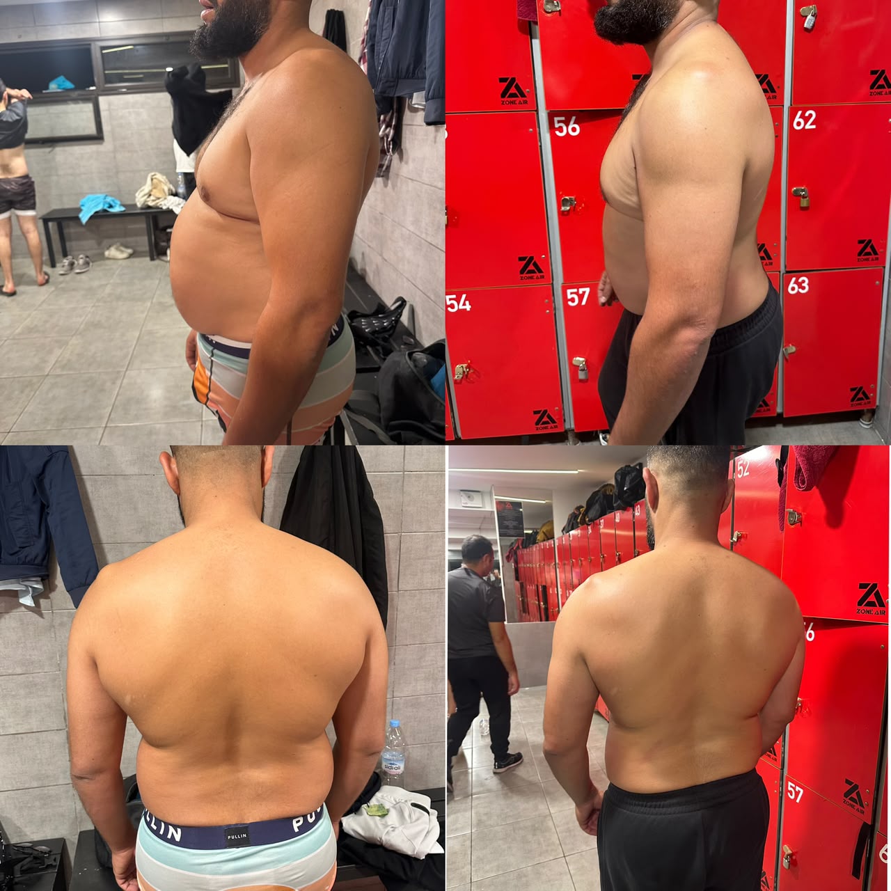 Photos avant et après d’un client, vues de profil et de dos